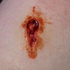 JessFX Prosthetic - Angled Entry Wound