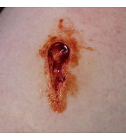 JessFX Prosthetic - Angled Entry Wound